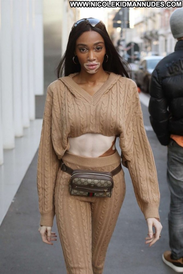 Winnie Harlow No Source Beautiful Babe Paparazzi Celebrity Posing Hot